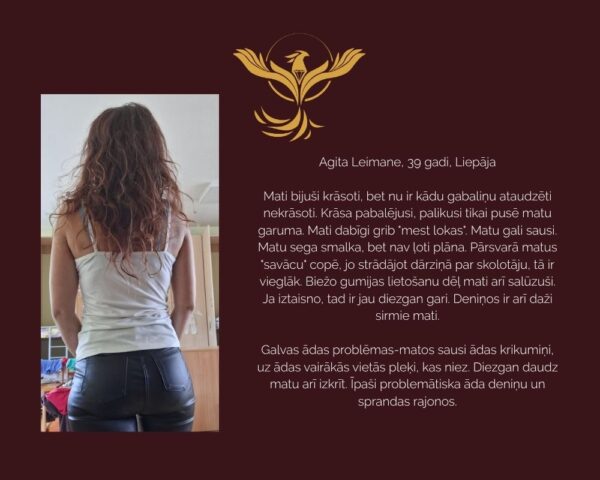 KOMPLEKTS MATU AUGŠANAI eļļa ar rozmarīnu, cinks un magnijs